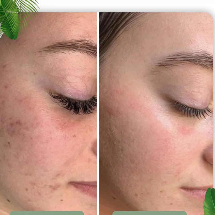 "Grøn Te Ansigtsmaske Stick - dybderensende stick, minimerer porer, grøn te farve, enkel brug"