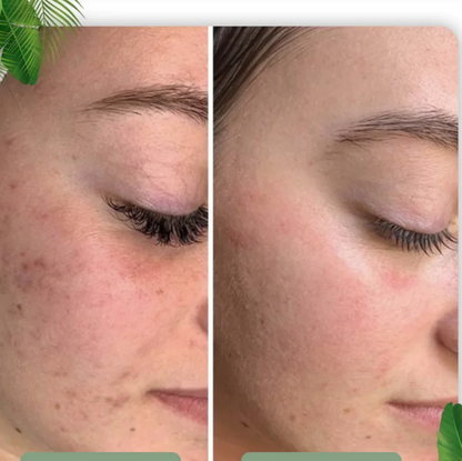 "Grøn Te Ansigtsmaske Stick - dybderensende stick, minimerer porer, grøn te farve, enkel brug"