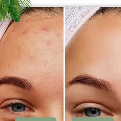 "Grøn Te Ansigtsmaske Stick - dybderensende stick, minimerer porer, grøn te farve, enkel brug"